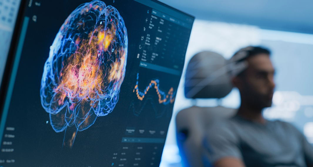 수면 뇌 검사 연결